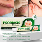🍃CREMA PSORIASIS– Tratamiento Natural para Tiña, Hongos y Psoriasis | 20g