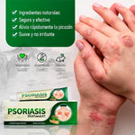 🍃CREMA PSORIASIS– Tratamiento Natural para Tiña, Hongos y Psoriasis | 20g